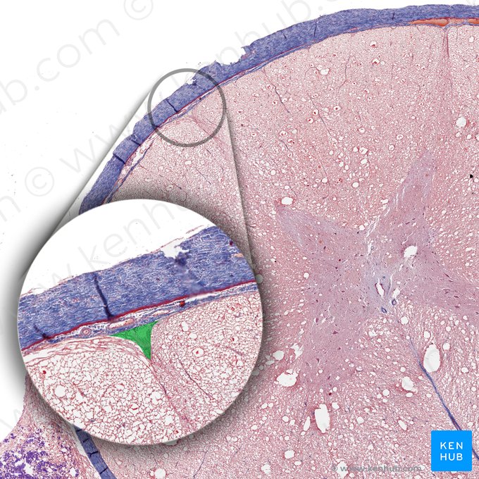 Surco posterolateral de la médula espinal (Sulcus posterolateralis medullae spinalis); Imagen: 