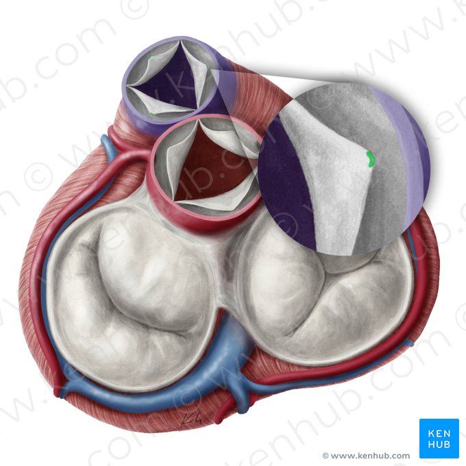 Nódulos de las válvulas semilunares de la valva pulmonar (Noduli valvularum semilunarium valvae trunci pulmonalis); Imagen: Yousun Koh