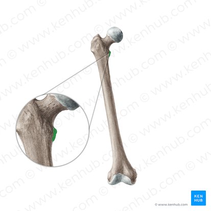 Lesser trochanter of femur (Trochanter minor ossis femoris); Image: Liene Znotina