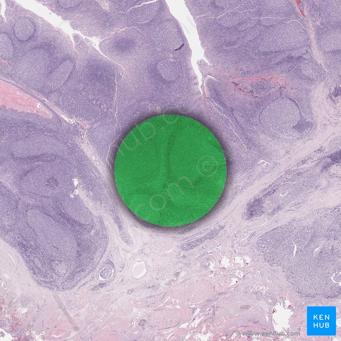 Reticular connective tissue; Image: 