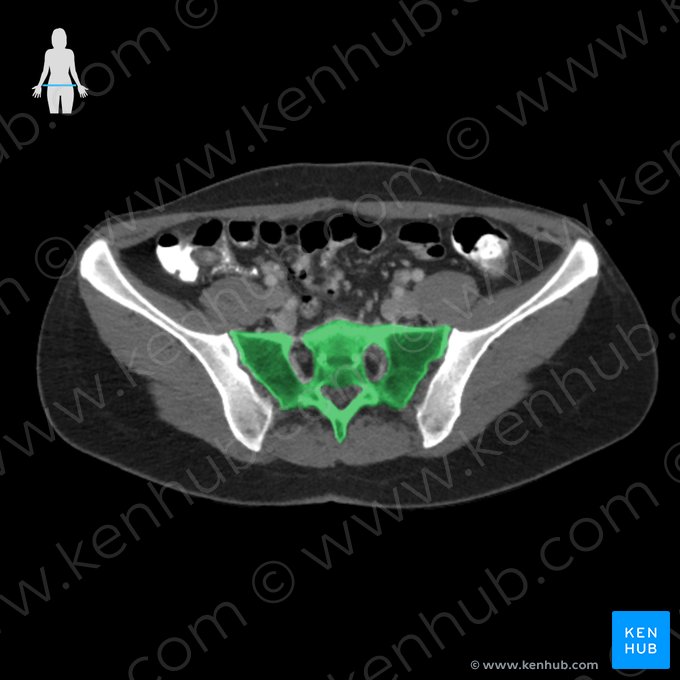 Os sacrum (Kreuzbein); Bild: 