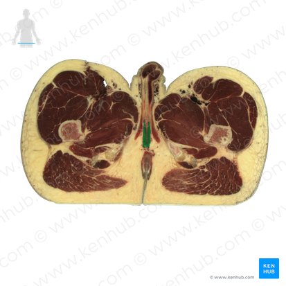 Bulbospongiosus muscle (male) (Musculus bulbospongiosus (masculinus)); Image: National Library of Medicine