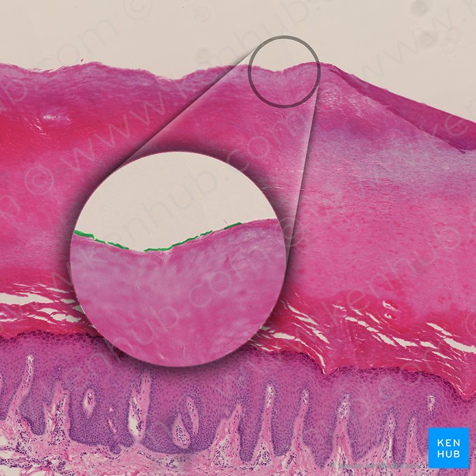 Estrato disyunto (Stratum disjunctum); Imagen: 