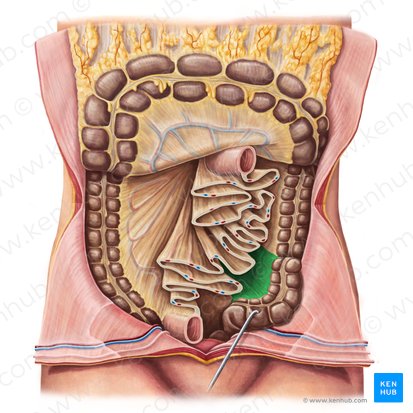 Sigmoid mesocolon (Mesocolon sigmoideum); Image: Irina Münstermann