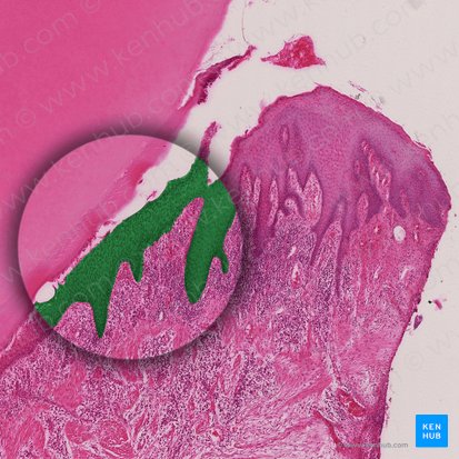 Sulcular epithelium; Image: 