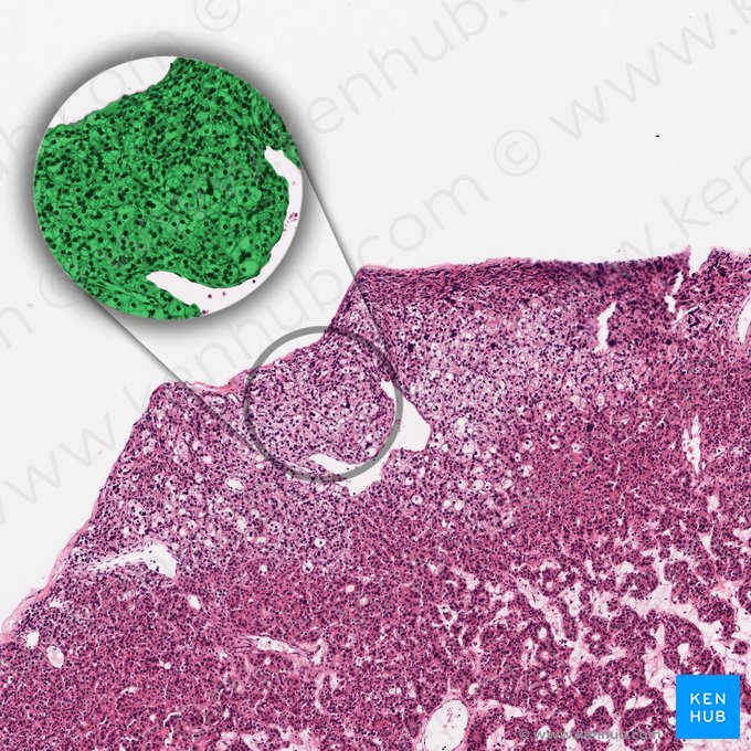 Parathyrocytus endocrinus (Hauptzelle); Bild: 