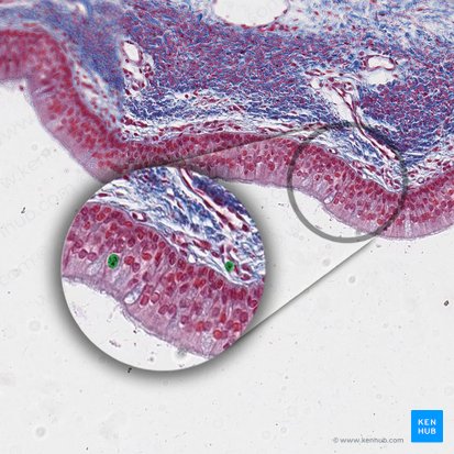 Mast cell (Mastocytus); Image: 
