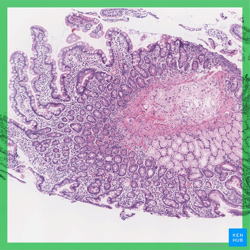 Duodenum - histological slide