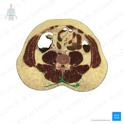 Fascia toracolumbar (Fascia thoracolumbalis); Imagen: National Library of Medicine