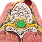 Spinothalamic tract