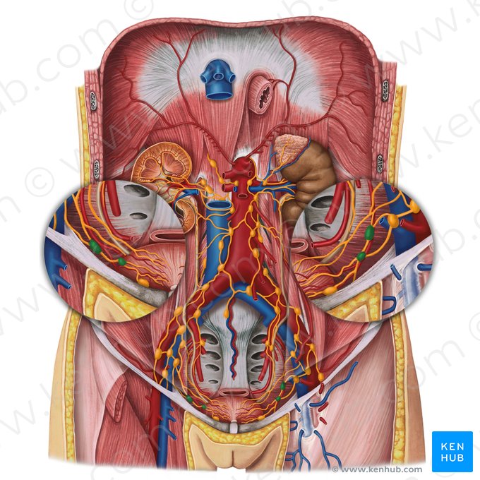 Nodi lymphoidei vesicales laterales (Seitliche Harnblasenlymphknoten); Bild: Irina Münstermann