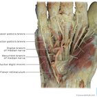Clinical case:  Glomus tumor of the hand misdiagnosed as carpal tunnel syndrome