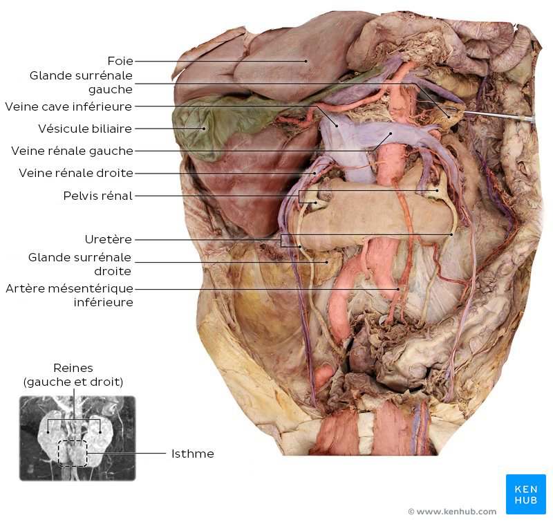 Veine cave inférieure dans un cadavre. Remarquez comme les plus grands affluents sont les veines rénales gauche et droite.