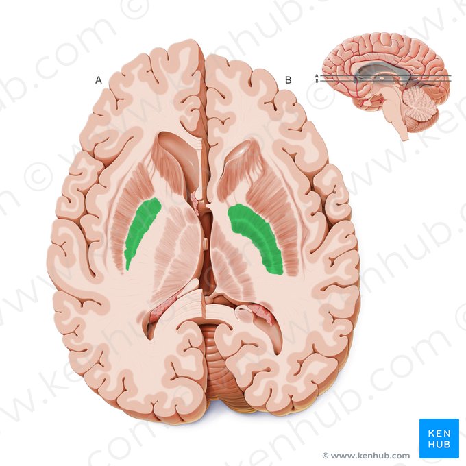 Globus pallidus (Blasser Kern); Bild: Paul Kim