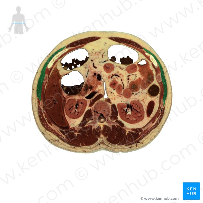 Músculo oblíquo externo do abdome (Musculus obliquus externus abdominis); Imagem: National Library of Medicine