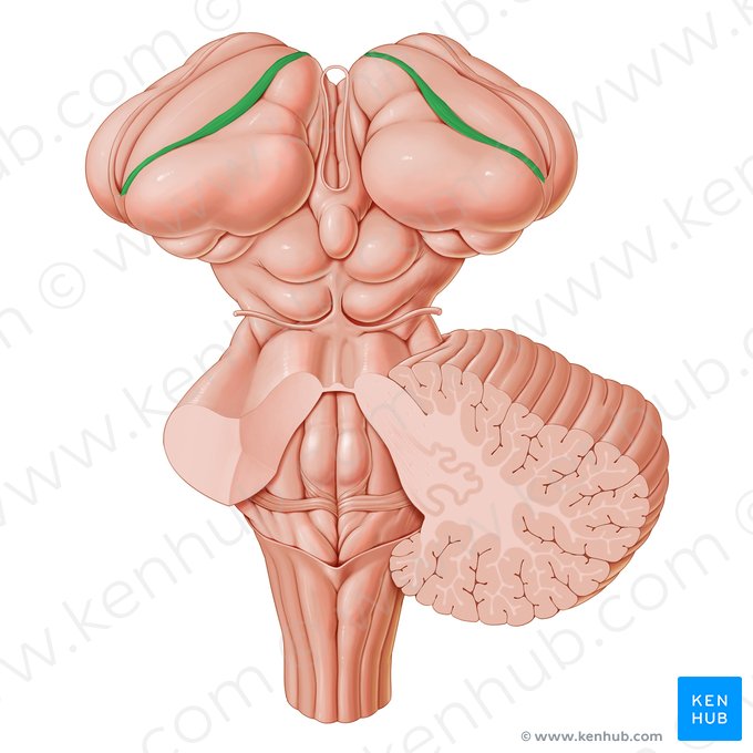 Choroid line (Taenia choroidea); Image: Paul Kim