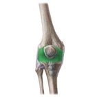 Cápsula articular