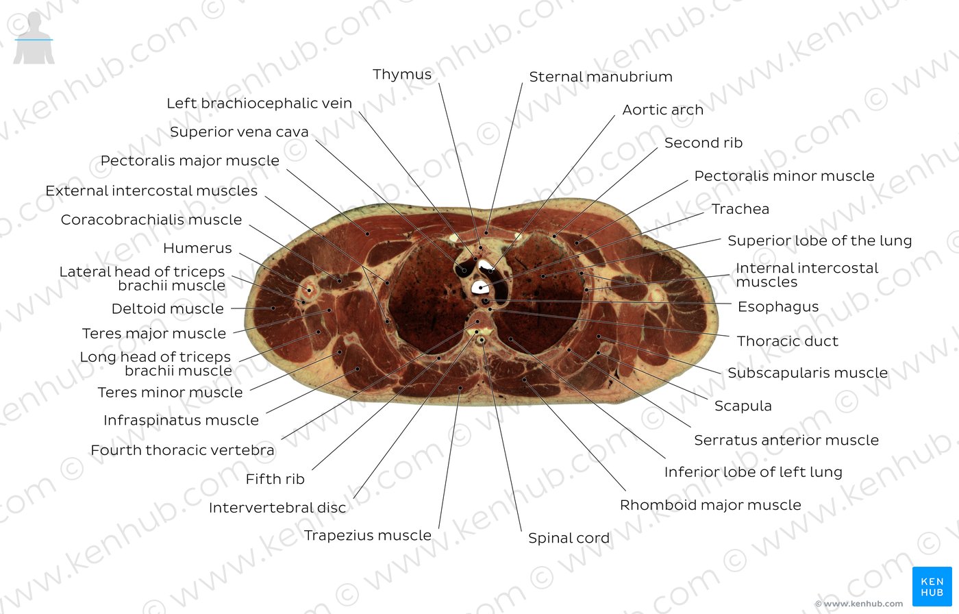 Fourth thoracic vertebra level: Overview