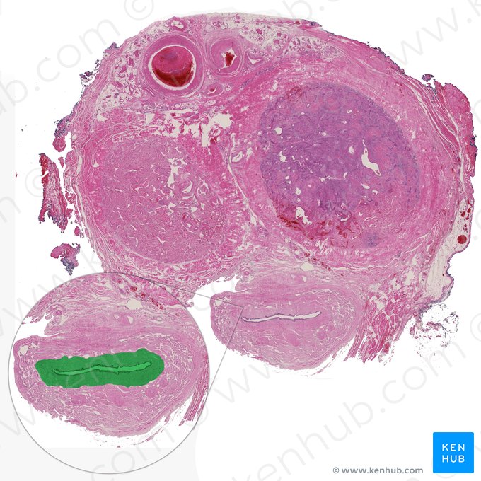 Uretra esponjosa (Pars spongiosa urethrae); Imagem: 