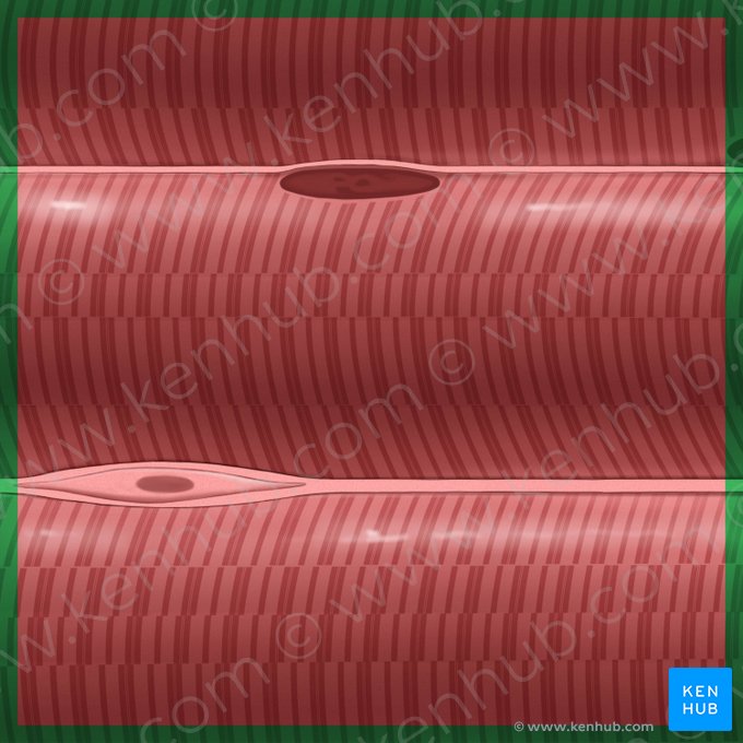 Skeletal muscle (Textus muscularis skeletalis); Image: Tal Bavli Ziv