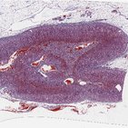 Suprarenal gland