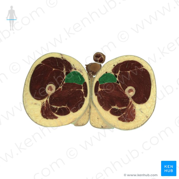 Musculus adductor longus (Langer Oberschenkelanzieher); Bild: National Library of Medicine