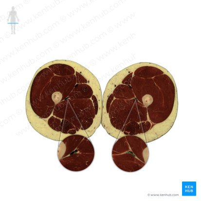 Arteria profunda femoris (Tiefe Oberschenkelarterie); Bild: National Library of Medicine