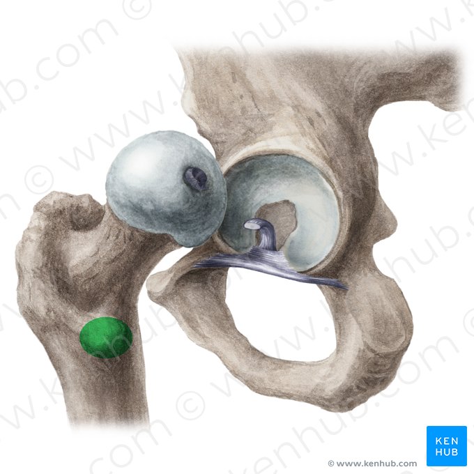 Lesser trochanter of femur (Trochanter minor ossis femoris); Image: Liene Znotina