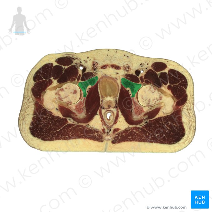 Púbis (Os pubis); Imagem: National Library of Medicine