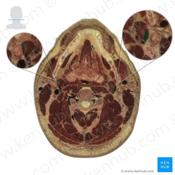 Ventre posterior do músculo digástrico (Venter posterior musculi digastrici); Imagem: National Library of Medicine