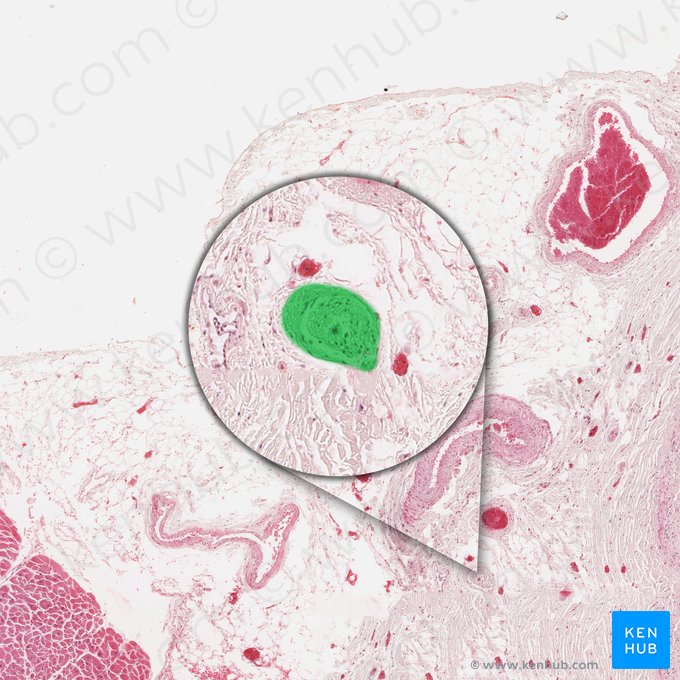 Autonomic nerve (Nervus autonomicus); Image: 