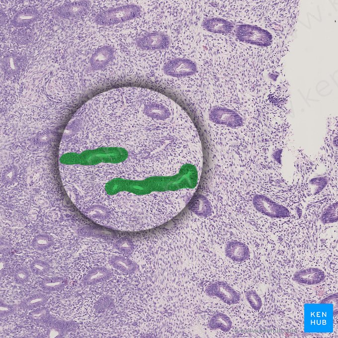 Long, curved endometrial glands; Image: 