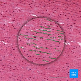 Elastic cartilage: Histology | Kenhub