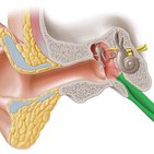 Eustachian (auditory) tube