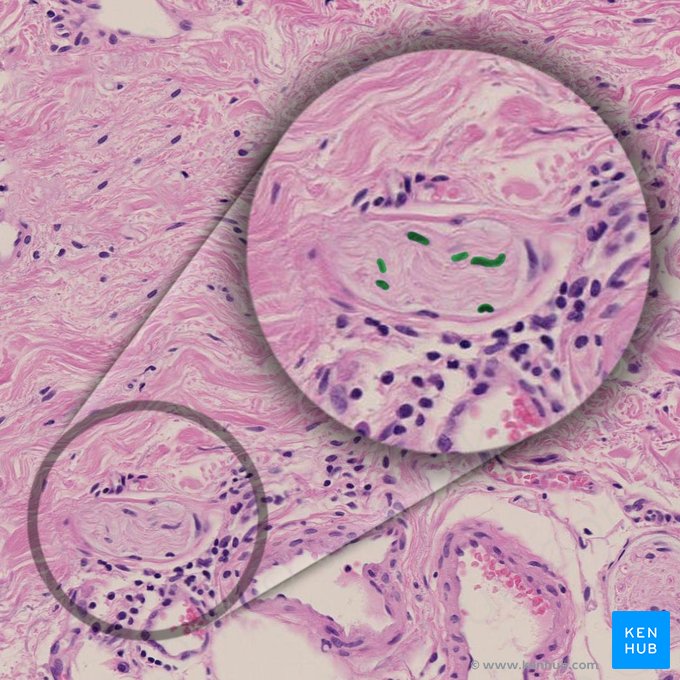 Schwann cell (Schwannocytus); Image: 