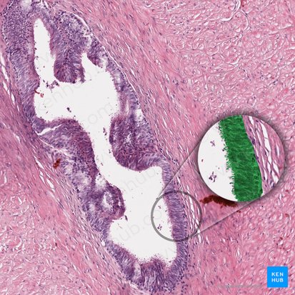 Pseudostratified columnar epithelium (with stereocilia) (Epithelium pseudostratificatum columnare stereociliatum); Image: 