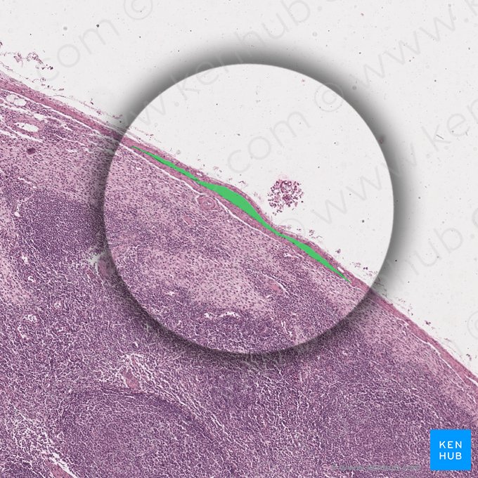 Seio subcapsular (Spatium subcapsulare); Imagem: 