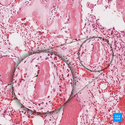Osteoblast (Osteoblastus); Image: 