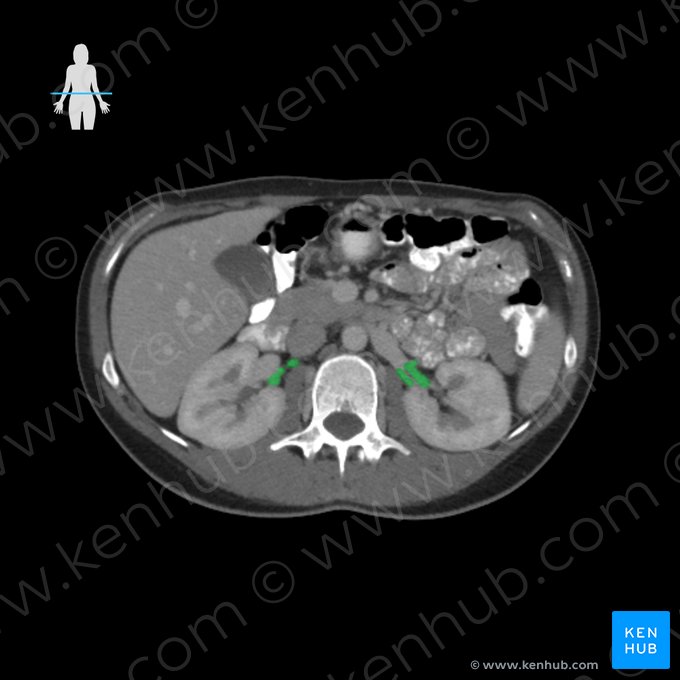 Renal artery (Arteria renalis); Image: 