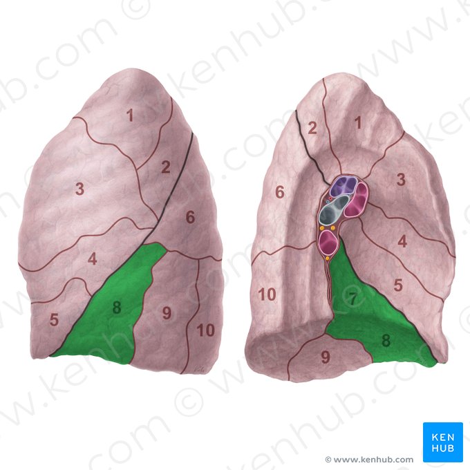 Segmentum basale anteromediale pulmonis sinistri (Vorderes inneres basales Segment der linken Lunge); Bild: Paul Kim