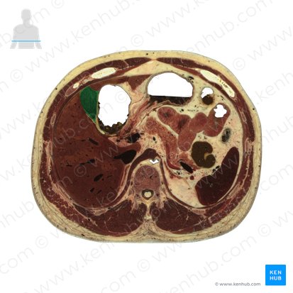 Gallbladder (Vesica biliaris); Image: National Library of Medicine