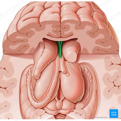 Septum pellucidum; Image: Paul Kim