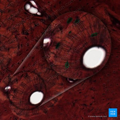 Laguna de osteocito (Lacuna osteocyti); Imagen: 