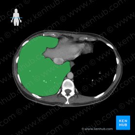 Right lung (Pulmo dexter); Image: 