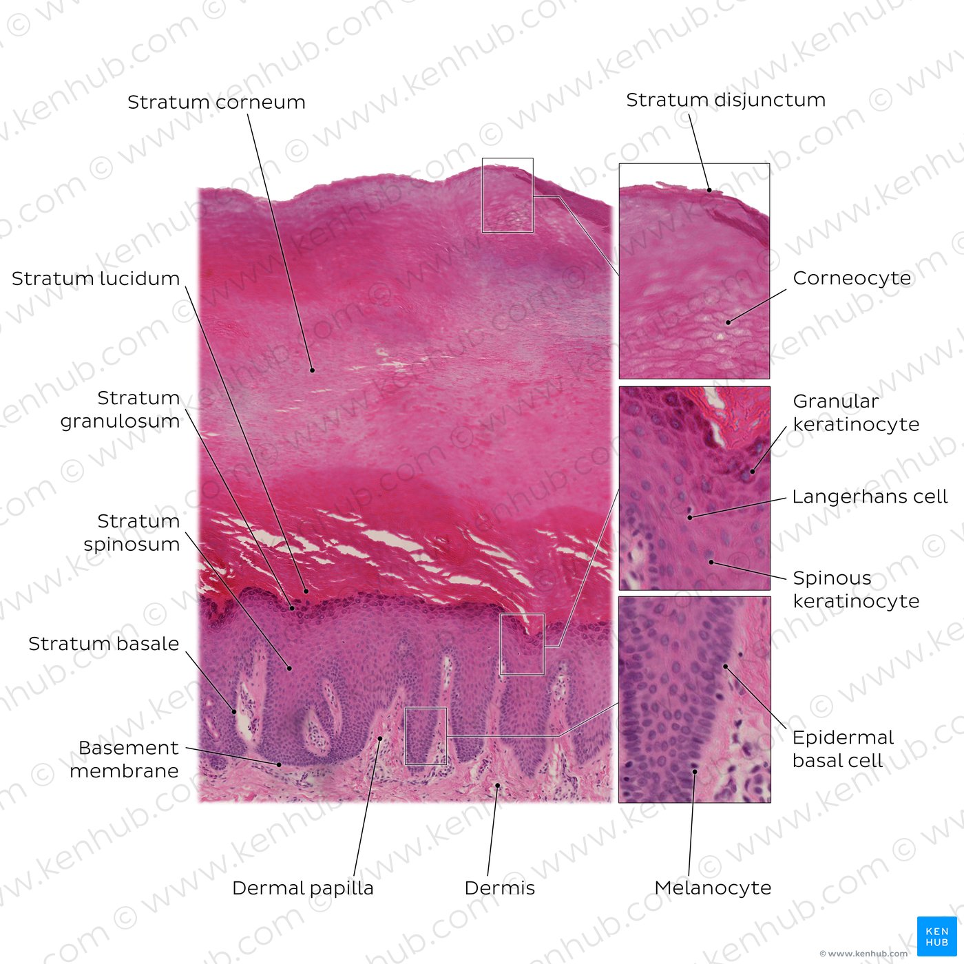 Layers of the epidermis. Stain: H&E. Medium magnification.