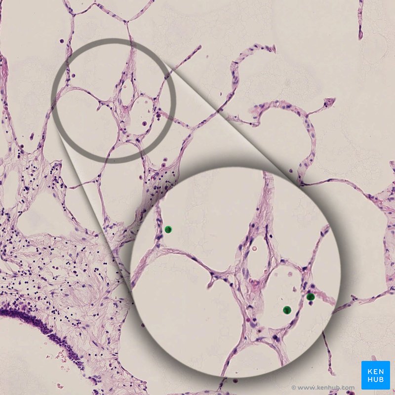 Macrófagos alveolares - lâmina histológica