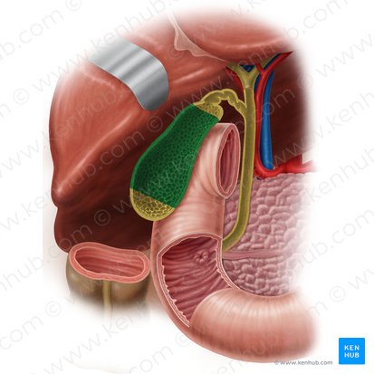 Corpo da vesícula biliar (Corpus vesicae biliaris); Imagem: Samantha Zimmerman