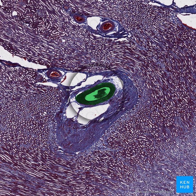 Arteria arcuata renis (Bogenarterie der Niere); Bild: 