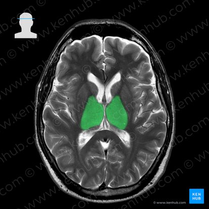 Tálamo (Thalamus); Imagem: 