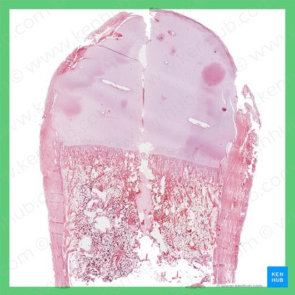 Osificación endocondral (Ossificatio endochondralis); Imagen: 